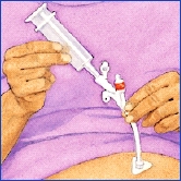Hands inserting syringe into port on feeding tube.