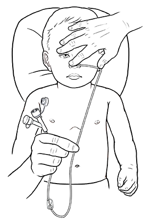Hands holding nasogastric tube to infant's nose, ear and abdomen to measure proper length.