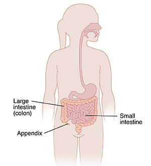 Outline of a child showing the small and large intestines and the appendix.