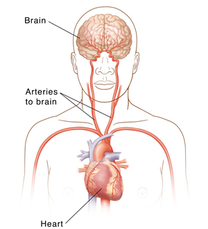 Front view of head and upper body showing carotid arteries, heart, and brain.