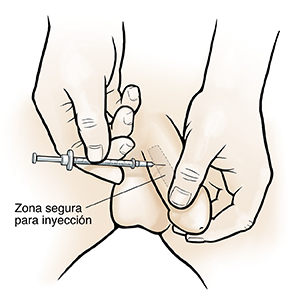 Hombre que se inyecta medicamento en el pene.