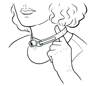 Primer plano de un cuello en el que se ve un tubo de traqueostomía y un dedo debajo de la cinta que sostiene el tubo.
